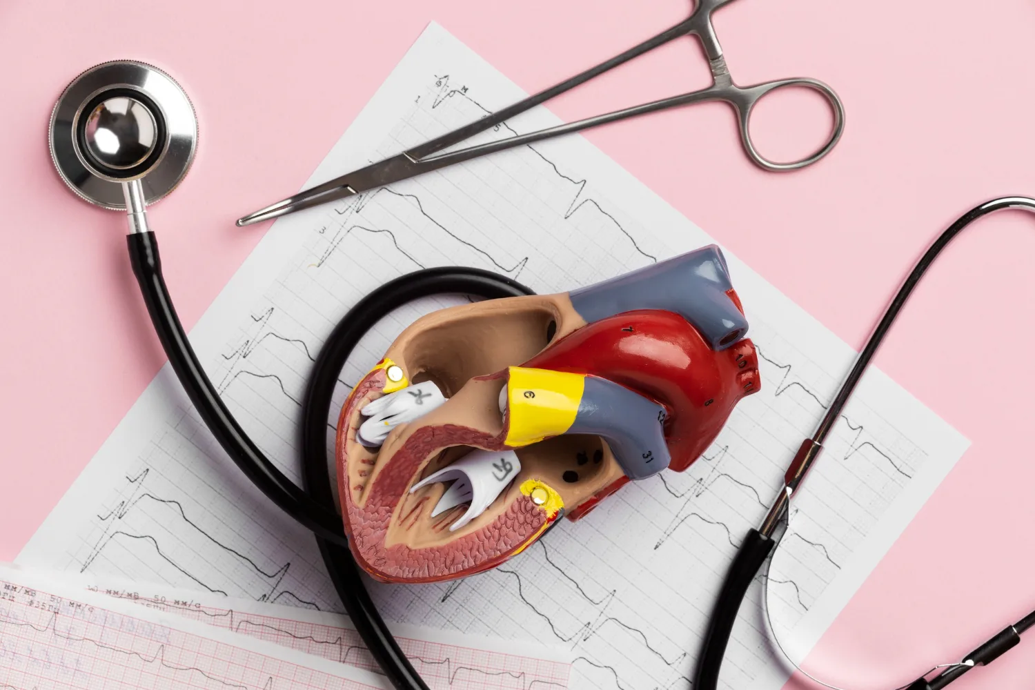 Implante Valvular Aórtico Transcatéter (TAVI/TAVR) en CDMX: La Revolución en el Tratamiento de la Estenosis Aórtica