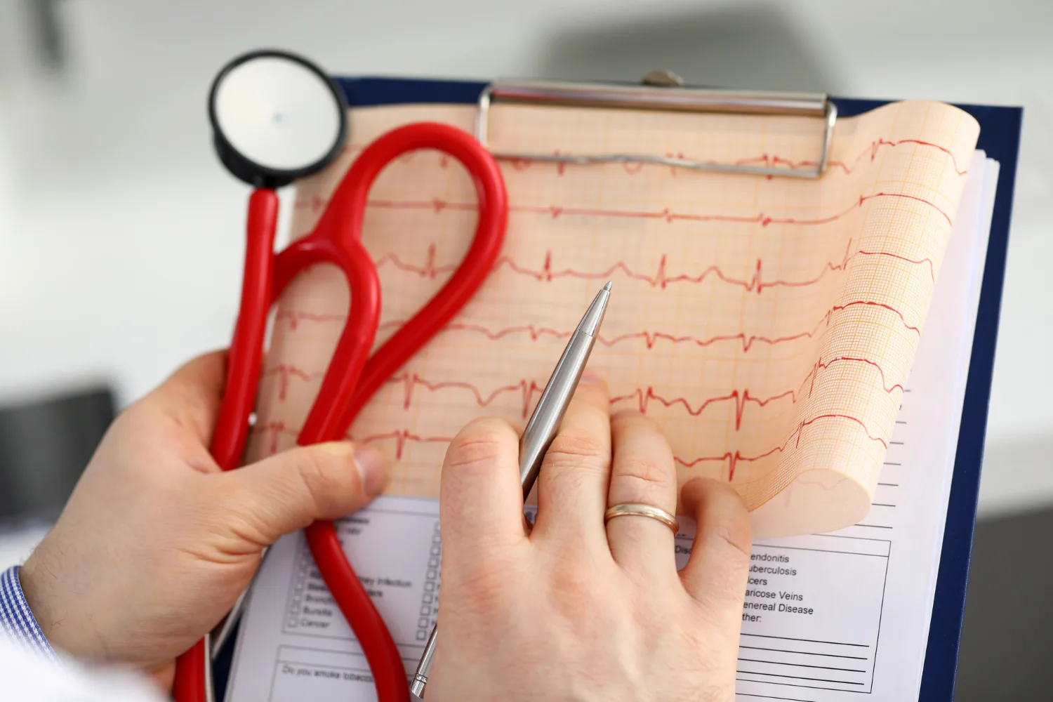Especialistas en Interpretación de estudios cardiológicos en CDMX: Precisión para tu corazón