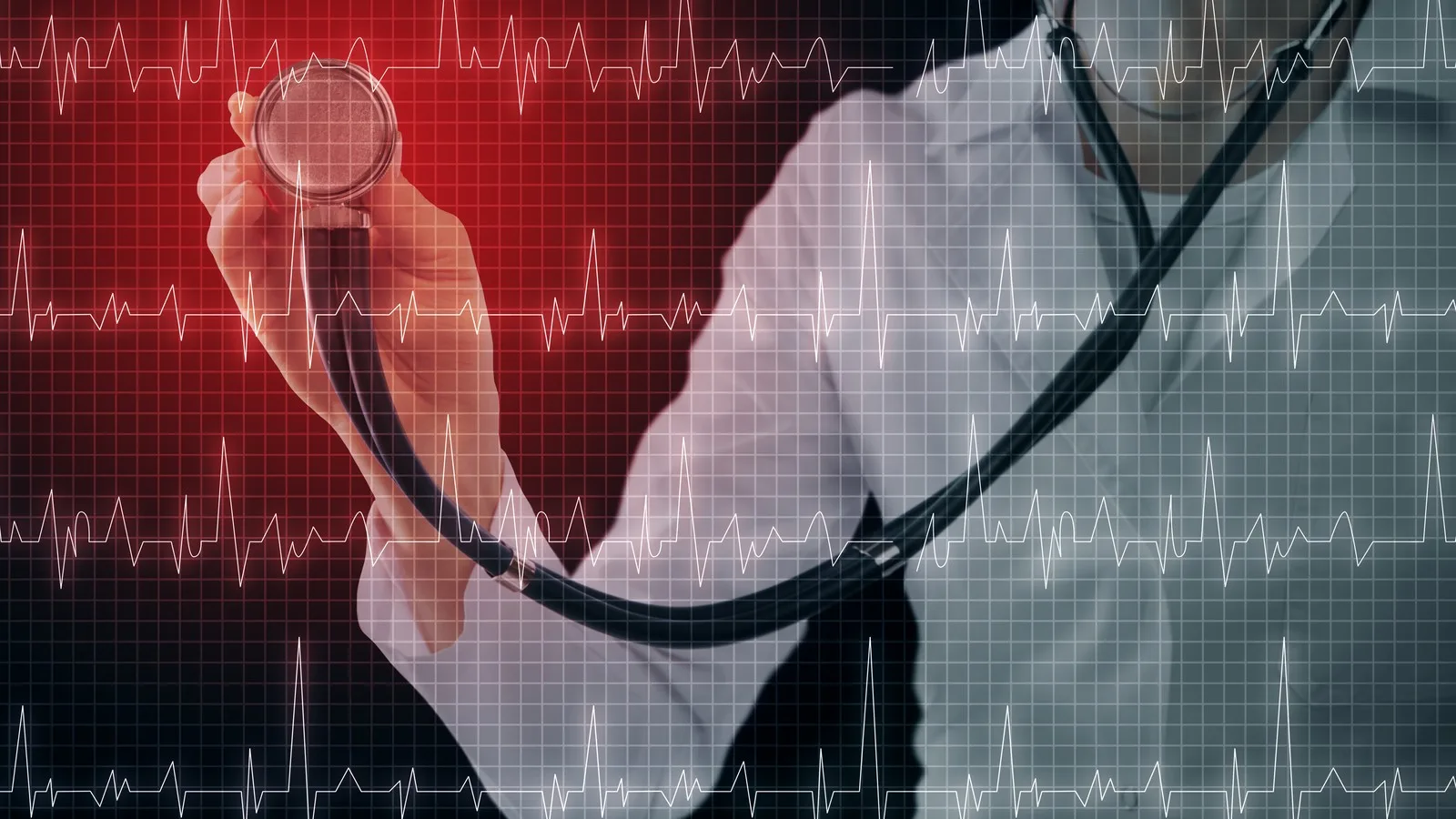 Realización de ecocardiograma cerca de CDMX