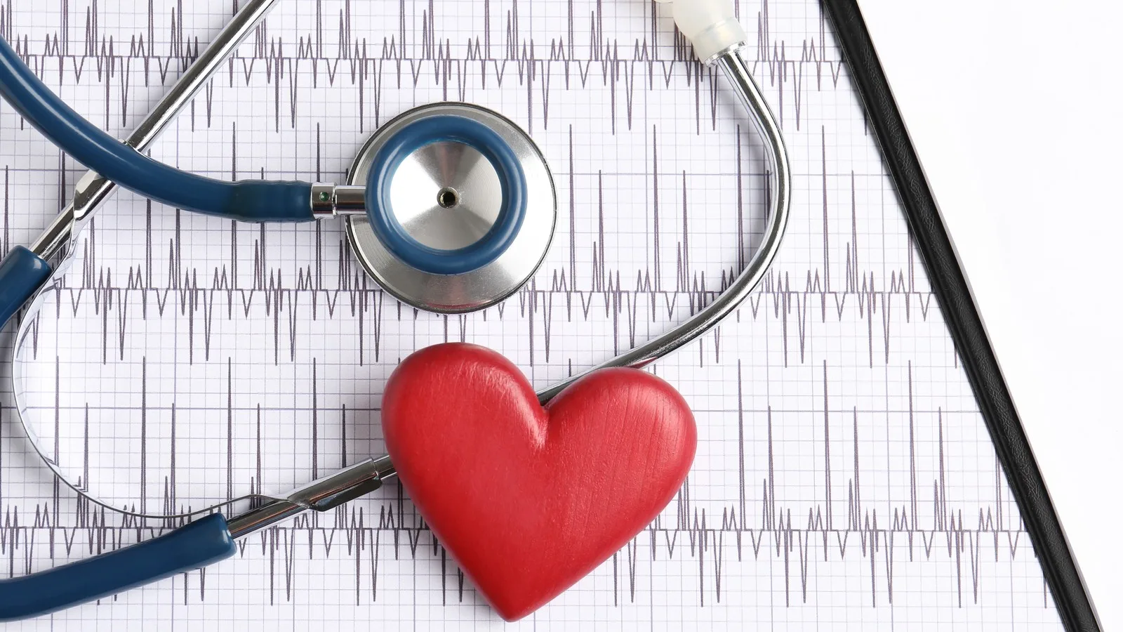 Electrocardiograma (ECG) en CDMX