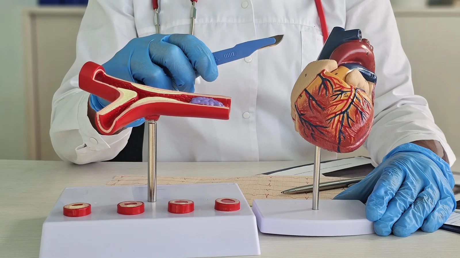 Precio de angioplastia coronaria y procedimientos cardiovasculares en CDMX