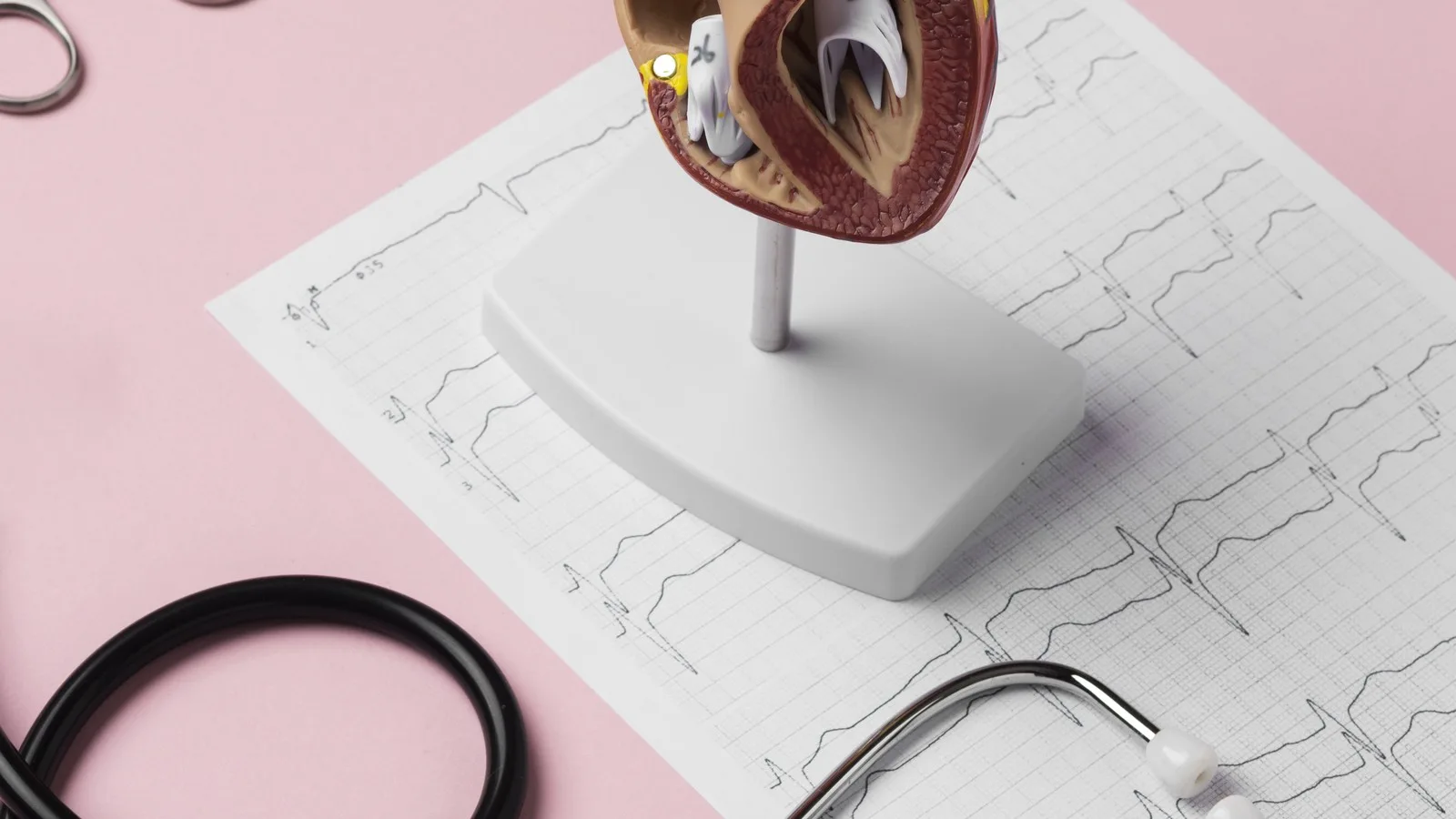 Precio de electrocardiograma en CDMX y estudios de valoración cardiovascular