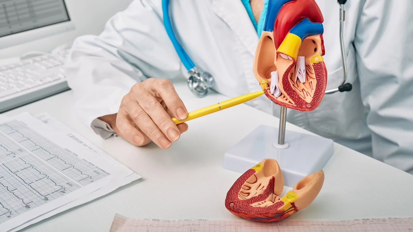 ¿Qué médico trata problemas cardíacos?